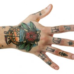【医師が教える】手の甲にある刺青にはデメリットが多い？除去する方法とは